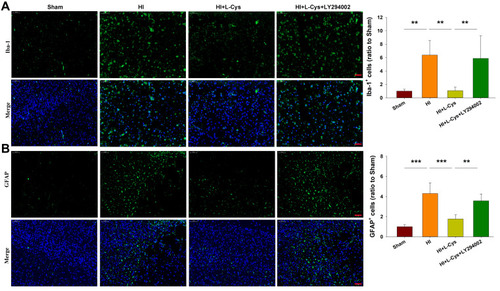Figure 6 L-Cysteine treatment suppresses HI-induced glia activation through the Akt pathway. Representative photographs indicating quantified numbers of cells within the right cortex at 72 h post-HI for (A) Iba-1 and (B) GFAP staining (Scale bar = 50 μm; N=4/group). Values represent the mean ± SD, **p < 0.01, ***p < 0.001 according to ANOVA.