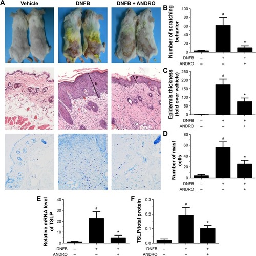 Figure 4 ANDRO improved the clinical symptoms in DNFB-induced AD mice via oral administration.