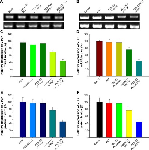 Figure 8 Relative levels of VEGF.Notes: (A, C) VEGF mRNA by real-time PCR in vitro and (B, D) in vivo; (E) VEGF protein by ELISA in vitro and (F) in vivo.Abbreviations: mRNA, messenger RNA; PCR, polymerase chain reaction; ELISA, enzyme-linked immunosorbent assay; PEG-SS-PLL, polyethylene glycol–poly(ε-benzyloxycarbonyl-l-lysine); siVEGF, small interfering VEGF RNA; PBS, phosphate-buffered saline.