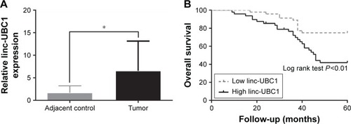 Figure 1 Expression of linc-UBC1 and OS curves in 96 patients with CRC.