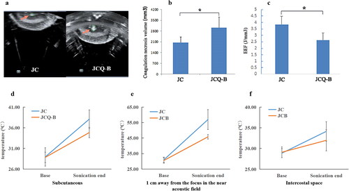 Figure 3. Hyperechoic changes in focal area in in vitro model and comparison of the biological effects and safety between the JC and JCQ-B transducers in ox liver tissue acoustic model under the same sonication parameters. (a) hyperechoic changes in the focal area generated by JC and JCQ-B transducers. (b) coagulation necrosis volume; (c) EEF, energy efficiency factor; (d) the increase of temperature in the subcutaneous area; (e) the increase of temperature in the near acoustic field; (f) the increase of temperature in the far acoustic field.