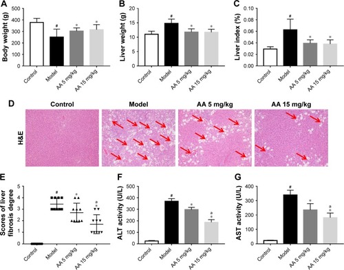 Figure 1 AA protects against CCl4-induced liver injury.