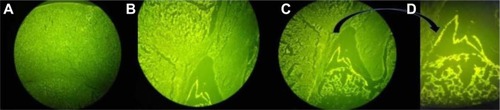 Figure 8 Fluorescent microscopy of the brain tissue.Notes: (A) Normal brain tissue in control group. (B–D) Fluorescent polyplexes in periventricular area. (A–C) Magnification ×100. (D) Magnification ×400.