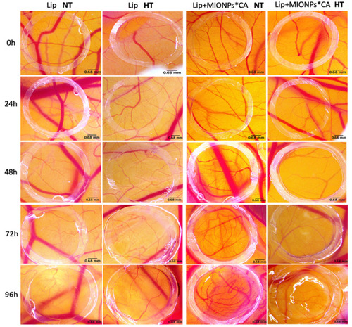 Figure 10 Stereomicroscopic in ovo images of the vascularized areas treated with blank liposomal samples (Lip and Lip+MIONPs*CA) at concentration of 25 µM, under normothermic – NT (37 °C) and hyperthermic pre-treatment – HT (46 °C). Three independent experiments were performed for each sample (n=3).