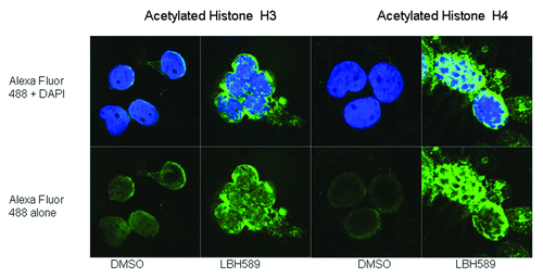 Figure 4. Immunohistochemistry. Histone acetylation in leukocytes was detected with rabbit anti-acetylated histone H3 and histone H4 antibodies with anti-rabbit Alexa Fluor 488 as the secondary antibody. Cells were counterstained with the nuclear DNA intercalating dye, DAPI. The upper panel of cells shows the merge of the green Alexa Fluor 488 acetylated histone staining with the blue nuclear DAPI stain, and the lower panels, acetylated histone staining alone. Histone H3 acetylation is less intense and localized to the periphery of the nucleus whereas Histone H4 acetylation is more intense and concentrated within the nucleus.