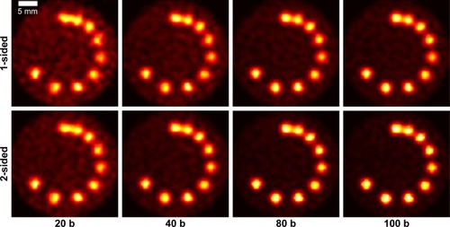 Figure 12 Reconstructed images for Phantom (II) obtained using (upper) one-sided and (lower) two-sided detectors with 20, 40, 80 and 100 billion particles.Note: Results are shown for the XFCT setup with multi-pinhole size of 1 mm.Abbreviations: b, billion; XFCT, X-ray fluorescence computed tomography.
