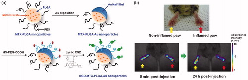 Figure 4. (a) Schematic depicting preparation of RGD-MTX-PLGA-AuNPs. (b) Application of RGD-MTX-PLGA-AuNPs for in vivo RA treatment (Reproduced with permission from American Chemical Society [Citation41]).