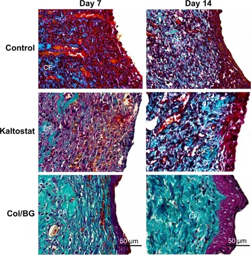 Figure 8 Masson staining of wound sections treated with the Col/BG nanofibers or Kaltostat at days 7 and 14. Untreated wounds were used as controls. Magnification ×200.Abbreviations: CF, collagen fiber; Col/BG, collagen/bioactive glass.