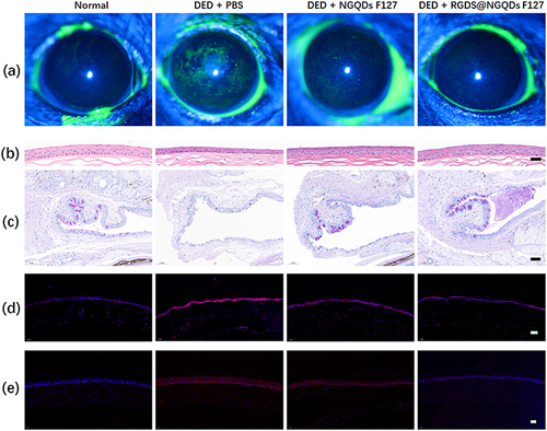 Figure 7 Representative diagnosis images of each group after 7 days of treatment. (a) fluorescein staining images; (b) histological images of corneas stained with H&E (scale bar: 50 μm); (c) histological images of conjunctiva stained with PAS (scale bar: 50 μm); (d) frozen sections of corneal tissue stained with DHE and DAPI (scale bar: 50 μm); (e) IL-1β detection by immunostaining on the corneal epithelial cells in the mice eyes after 7 days of treatment (scale bar:20 μm).