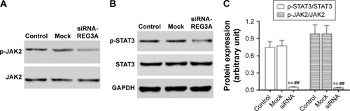 Figure 4 REG3A regulated the JAK2/STATS signal pathway in GC cells.