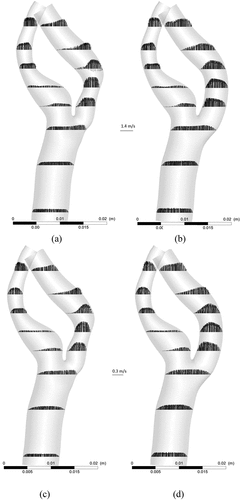 Figure 10. Mid-plane velocity vectors; (a) near peak systole for stenosed model, (b) near peak systole for stented model, (c) at peak diastole for stenosed model, (d) at peak diastole for stented model.