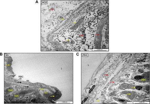 Figure 31 Ultrastructural electron micrographs of aortic endothelial cells (ECs) in HCD (A), SG (B), and ZSG (C) groups.