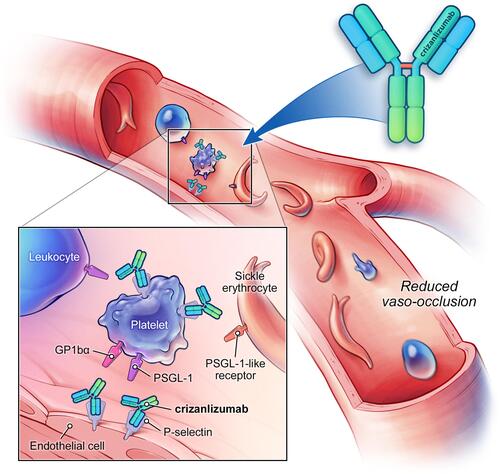 Figure 1 Mechanism of action of crizanlizumab. Crizanlizumab is a monoclonal antibody that binds to P-selectin. Blockade of P-selectin may prevent cell–cell interactions between blood cells and endothelial cells, and thus eliminate or reduce vaso-occlusion. Figure reproduced with permission from© 2020 Novartis AG.
