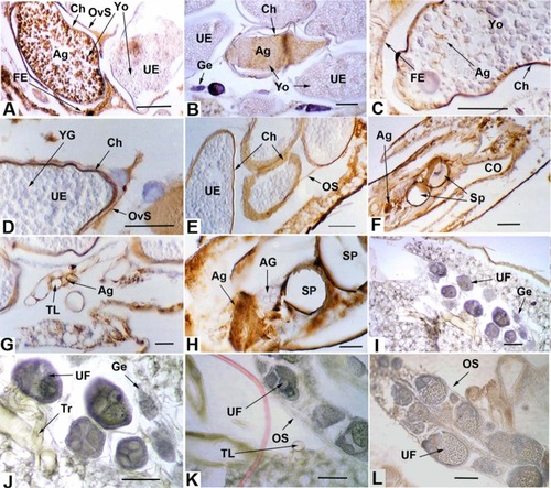 Figure 1 (A, B) RVFV antigen in chorionated eggs showing pathology and RVFV antigen-negative germarium (B). (C) Chorionated egg with distinct traces of RVFV antigen. (D) Uninfected chorionated egg with antigen-positive ovariolar sheath. (E) Uninfected chorionated eggs with RVFV antigen-positive ovarian sheath. (F) Sagittal section in posterior part of the abdomen showing antigen-positive oviduct epithelium and tissues in proximity to the spermathecae. (G) Antigen-positive small tracheae associated with the ovaries. (B) Section of spermathecae and adjacent antigen-positive tissues, and antigen-negative accessory gland. (I–L) Negative control sections.