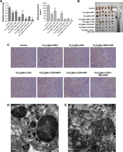 Figure 9 Efficacy of various therapeutic strategies in treating nude mice bearing U251 glioma tumors.Notes: (A) The quality and volume changes of stripped tumors in various treatment groups. (B) Tumors rejected from mice in various treatment groups. (C) Histopathologic examination of human glioma transplanted in nude mice (hematoxylin/eosin staining, ×100 magnification). Transmission electron microscopy of the tumors exposed to Fe3O4@Au-C225 MNPs-mediated combined hyperthermia (MFH+NIR). (D) Numerous vesicles containing the aggregative Fe3O4@Au-C225 MNPs. (E) The denatured collagen zones in the close vicinity of Fe3O4@Au-C225 MNPs localization. *Compared with the negative control group, P<0.05; #Fe3O4@Au-C225 MNPs compared with Fe3O4@Au MNPs when exposed to AMF combined with NIR, P<0.05.Abbreviations: AMF, alternating magnetic field; C225, cetuximab; MFH, magnetic fluid hyperthermia; MNPs, magnetic nanoparticles; NIR, near-infrared hyperthermia.