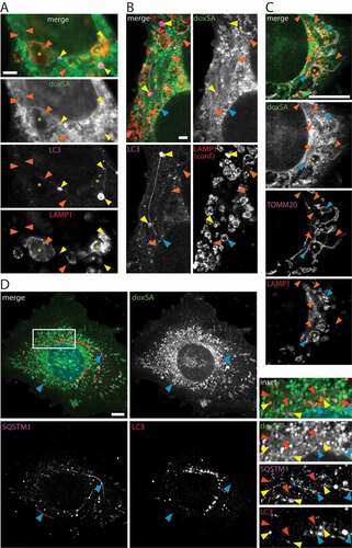 Figure 4. Lipid aggregates interact with the autophagosomal apparatus. MEF cells were treated with 1 μM (A-C) or 2 μM (D) doxSA mix for 24 h. After fixation cells were probed for various organelle markers by immunofluorescence and the alkyne moiety was reacted with N3635P-reporter (A–C) or N3picCy3-reporter (D). STED-micrographs (A–C) or maximum image projections of z-stacks recorded using structured illumination (D) depict alkyne lipids (green, doxSA), mitochondria (magenta, TOMM20), lysosomes (red, LAMP1), autophagosomes (magenta (A,B, LC3; D, SQSTM1) or red (D, LC3)) as color-merged or grayscale images. Note the straight lipid aggregates (orange arrowheads) neighboring large lysosomes (A,C, asterisks), autolysosomes (A,B, yellow arrowheads) and lysosomes (B, blue arrowheads) interconnected by straight and curved protrusions. Also note the close approximation of lipid aggregates and elongated SQSTM1-positive structures (D, blue arrowheads) and autophagosomes (D, yellow arrowheads). In (B) the LAMP1-signal was recorded as a confocal image. Scale bars, (A,B) 2 μm, (C,D) 10 μm