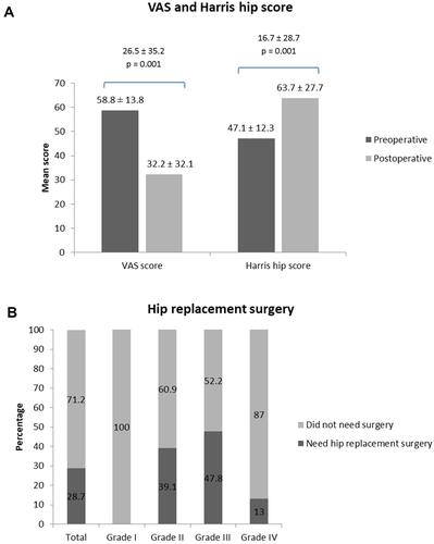 Figure 3 (A) Changes in visual analog scale (VAS) and Harris hip scores. (B) Need for hip replacement surgery in different grades of osteonecrosis. (Osteonecrosis graded according to Association Research Circulation Osseous criteria).