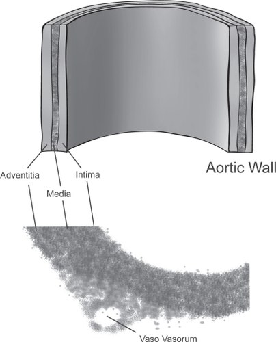 Figure 1 Layers of aortic wall.