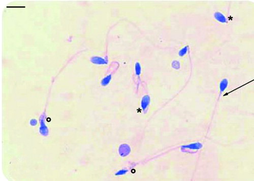 Figure 3.  Light microscopy (LM) micrograph (Papanicolaou staining, PAP) showing normal sperm (arrow), sperm with normal acrosomes, and nuclei but altered tails (*), sperm with altered nuclei and/or tails (°). Bar 12 µm.