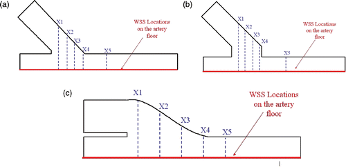 Figure 12. The x-velocity profiles and WSS locations for the three ETSDA models.