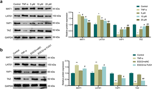 Figure 6. EGCG can inhibit TNF-α-caused activation of the Hippo/YAP pathway in MC3T3-E1 cells. a: Western blot was adopted to check the influence of EGCG at different concentrations of 5 μM, 10 μM, 20 μM on the expression of Hippo/YAP pathway-related proteins MAT1, LATS1, YAP1, and TAZ. *P < 0.05, **P < 0.01 vs. Control group; #P < 0.05, ##P < 0.01 vs. TNF-α group. b: Western blot was adopted for the test of the influence of different TUG1 expression and EGCG on the expression of Hippo/YAP pathway-related proteins MAT1, LATS1, YAP1, and TAZ. **P < 0.01 vs. Control group; #P < 0.05, ##P < 0.01 vs. EGCG+ siNC group.