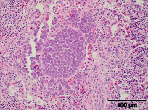 Figure 3.  A macromeront within the spleen of a juvenile brown kiwi (H&E stain). Scale bar = 100 µm.