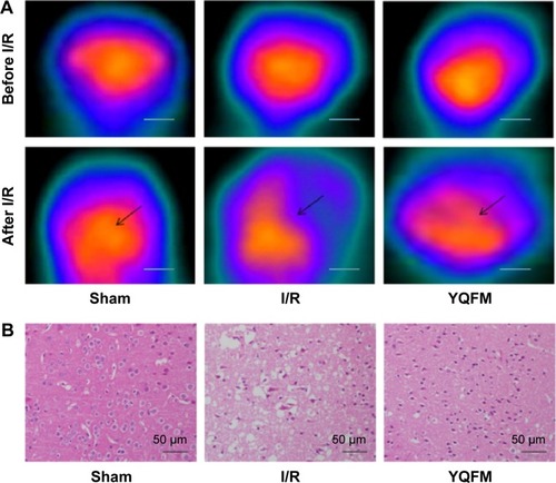Figure 5 Effect of YQFM on histopathological changes of brain sections in mice with cerebral I/R.