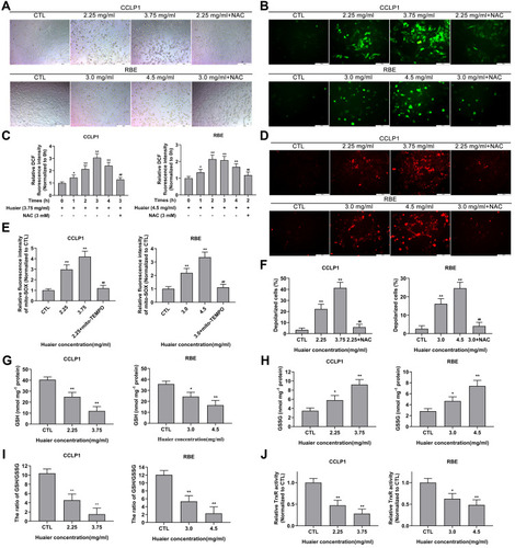 Figure 3 Huaier causes morphological change, induces oxidative stress, and unbalances the oxidation-reduction system in CCA cells. (A) The cellular morphological changes of CCLP1 and RBE cells caused by Huaier were analyzed by applying image analysis. (B and C) Effect of Huaier on oxidative stress levels in CCLP1 and RBE cells was initially detected by DCFH-DA fluorescent probe under inverted fluorescence microscope and microplate reader. *P < 0.05, **P < 0.01 versus CTL. ##P < 0.01 versus Huaier (3.75 mg/mL for CCLP1) at 3 h or Huaier (4.5 mg/mL for RBE) at 2 h. CTL, control. (D and E) Effect of Huaier on oxidative stress levels in CCLP1 and RBE cells was further assessed by mito-SOX fluorescent probe under inverted fluorescence microscope and microplate reader. **P < 0.01 versus CTL. ##P < 0.01 versus Huaier (2.25 mg/mL for CCLP1 or 3.0 mg/mL for RBE) single treatment groups. CTL, control. (F) JC-1 probe was performed to evaluate the effect of Huaier on MMP in CCLP1 and RBE cells. **P < 0.01 versus CTL. ##P < 0.01 versus Huaier (2.25 mg/mL for CCLP1 or 3.0 mg/mL for RBE) single treatment groups. CTL, control. (G–I) The GSSG/GSH quantification kit was applied to assess the effect of Huaier on intracellular GSH, GSSG levels and the ratio of GSH to GSSG in CCLP1 and RBE cells. *P < 0.05, **P < 0.01 versus CTL. CTL, control. (J) The thioredoxin reductase assay kit was used to detect the effect of Huaier on intracellular TrxR activity. *P < 0.05, **P < 0.01 versus CTL. CTL, control. Magnification, ×100 (A), × 200 (B and D). Scale bar, 200 μm (A), 100 μm (B and D). Mean ± SD of three independent experiments is shown.Abbreviations: SD, standard deviation; CCA, cholangiocarcinoma; DCFH-DA, 2ʹ, 7ʹ-dichlorofluorescein-diacetate; NAC, N-acetylcysteine; GSH, glutathione; GSSG, oxidized glutathione; TrxR, thioredoxin reductase.