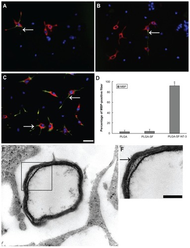 Figure 7 Formation of myelin sheath in the coculture system. NSCs and SCs in the cells/PLGA were cultured for 14 days, and immunostained with antibodies against neuron and myelin sheath markers (Map2 = red versus MBP = green). Nuclei were labeled by DAPI (blue). (A) Arrow indicates segments of neuronal axons wrapped by (MBP-positive) myelin sheath in PLGA; (B) the PLGA-SF group; and (C) PLGA-SF-NT-3 group, respectively; (D) Abundance of MBP-positive fibers in the PLGA-SF-NT-3 group compared with other groups (P < 0.05; n = 3 for each group); (E) TEM showing formation of the myelin sheath in the PLGA-SF-NT-3 group; (F) Typical, characteristic sheath composed of several layers wrapped around axons.Note: Scale bar = 20 μm in (A–C), 200 nm in (F).Abbreviations: NSCs, neural stem cells; SCs, Schwann cells; PLGA, poly-(lactic acid-co-glycolic acid); SF, silk fibroin; NT-3, neurotrophin-3; Map2, microtubule-associated protein 2; MBP, myelin basic protein; TEM, transmission electron microscopy.