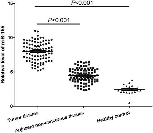 Figure 1. Relative miR-155 expression levels. The expression of miR-155 in ESCC tissues was significantly higher than that in matched adjacent samples (p < .001) and healthy control specimens (p < .001).