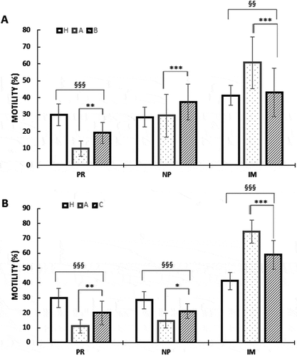Figure 1. Effects of nutraceuticals mix and MI on motility (A) in vitro (B) in vivo. Motility is expressed as percentage in healthy volunteer’s donors (H), OAT untreated patients (A), sperm from OAT patients treated in vitro with a concentrated solution of MI (B) and OAT patients treated in vivo with a nutraceuticals mix, containing mainly MI (C). PR = progressive motility, NP = non-progressive motility, IM = immobile sperm). The columns represent the mean ± SD. Variables before and after treatment analyzed with Student’s paired t-test. p-value: * ≤ 0.05; ** < 0.01; *** < 0.001. One-way ANOVA between groups. p-value: § ≤ 0.05; §§ < 0.01; §§§ < 0.001.