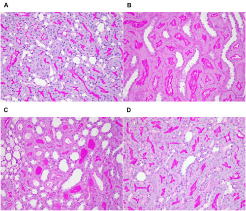 Figure 10 Light microscopy images of PAS-stained renal tissue (×400). (A) Sham group; (B) CLP group, dilatation of renal tubules, shedding of brush margin, flattening and shedding of renal tubular epithelial cells; (C) CLP group, renal tubules were formed (D) CLP+Cur group, the degree of damage was lesser than that of CLP group.