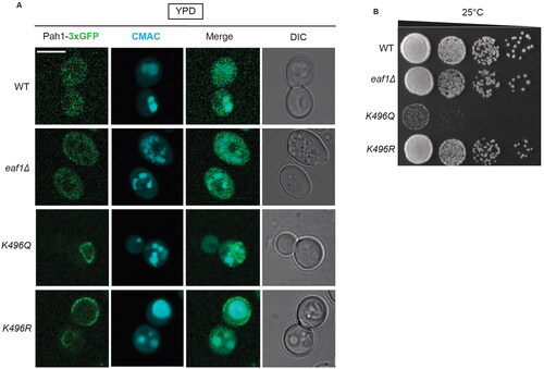 Figure 7. Pah1-K496 confers changes in Pah1 localization. (A) Single sliced Z-stack images showing Pah1-3xGFP localization, and vacuoles labeled with CMAC in the WT PAH1-3xGFP (YKB 4993), eaf1Δ PAH1-3xGFP (YKB 4994), PAH1-K496Q-3XGFP (YKB 5130) and PAH1-K496R-3XGFP (YKB 5131) strains. Scale bar = 5 μm. (B) Dot assays showing growth of WT PAH1-3xGFP (YKB 4993), eaf1Δ PAH1-3xGFP (YKB 4994), PAH1-K496Q-3XGFP (YKB 5130) and PAH1-K496R-3XGFP (YKB 5131) after a period of 48 h at 25 °C.