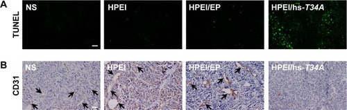 Figure 10 The effect of HPEI/hs-T34A complexes on apoptosis and angiogenesis of ovarian tumor cells.Notes: (A) TUNEL assay was carried out to examine the apoptotic cells of ovarian tumor in NS, HPEI alone, HPEI/EP, or HPEI/hs-T34A complexes group, respectively. Scale bar, 50 μm. (B) CD31 staining was performed to assess angiogenesis of ovarian tumor in NS, HPEI alone, HPEI/EP, or HPEI/hs-T34A complexes group, respectively. Scale bar, 50 μm. The arrows show the CD31 positive vascular tissue.Abbreviations: HPEI, heparin–polyethyleneimine; TUNEL, terminal deoxynucleotidyl transferase dUTP nick end labeling; EP, empty vector plasmid; NS, normal saline; CD31, clusters of differentiation 31; hs, human survivin.