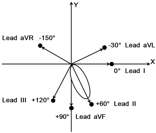 Figure 1. Schematic diagram of limb lead locations anatomically. Display full size, Anatomical location of limb leads; Display full size, direction of cardiac electrical force sum vector received by limb leads; Display full size, heart.