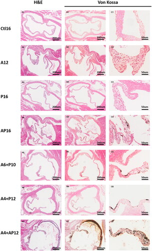 Figure 5. Representative histopathological images in aorta valvular tissues from different groups. Aorta valvular tissues were evaluated in each group using hematoxylin and eosin (H&E) (A1–7), and von Kossa (B1–7, C1–7).