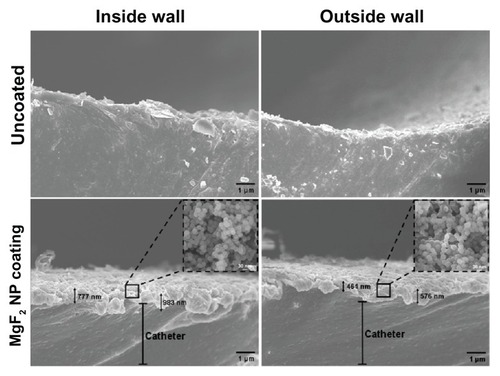 Figure 2 Imaging of sonochemical MgF2 NP catheter coating. Catheters were coated using a sonochemical procedure described in the experimental section. HR SEM images of the lateral sections of the internal and external walls of uncoated and MgF2 NP-coated catheters are presented. Inserts provide an enlarged view of the coating showing the typical spherical MgF2 NP structure.Note: Black arrows indicate the thickness of the MgF2 NP coating.Abbreviations: HR SEM, high resolution scanning electron microscope; NP, nanoparticle.