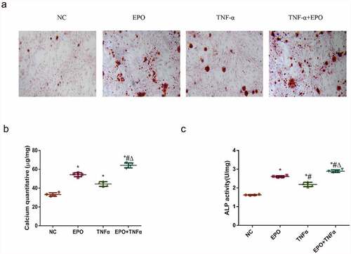 Figure 1. TNF-α aggravated EPO-induced calcification in VSMCs. VSMCs were cultured with single EPO (250 U/mL) or combined with 20 ng/mL TNF-α for 14 d. A. Alizarin red staining (magnification ×200). B. Determination of calcium content. C. Detection of ALP activity in VSMCs following 8 d treatment. The results are expressed as mean ± SD; n=3. * p<0.05 vs. NC group, # p<0.05 vs. EPO group, Δ p<0.05 vs. TNF-α group.