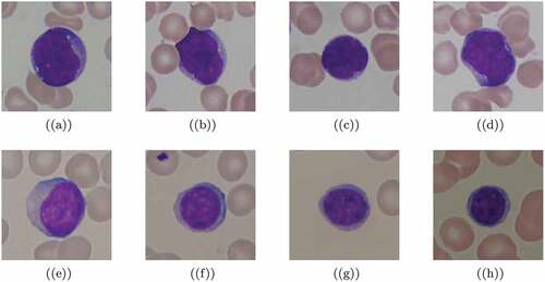 Figure 3. Sample images from ALL-IDB1 dataset. First four lymphocytes (a – d) are cancerous while the remaining lymphocytes (e – h) are not. Lymphocyte cells are classified by expect oncologists.