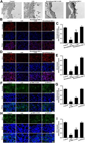 Figure 8 Recombinant mouse SDC-1 protein alleviated glycocalyx shedding and tight junction damage in mice, and overexpression SDC-1 alleviated tight junction damage in A549 cells. The mice were intratracheally atomized with 500 ng/day recombinant SDC-1 protein for 7 days and then exposed to LPS to stimulate for six hours. The lipofectamine 3000 reagent and pc-SDC-1 (1 µg/mL) were employed for A549 cells transfection. Forty-eight hours after transfection, the A549 cells were cultured with LPS (100 ng/mL) stimulation for six hours. Glycocalyx was conducted by an electron microscope (A: scale bar = 0.2 µm). Occludin in mice (B, magnification, × 200; scale bar, 50 μm) and A549 cells (F, magnification, × 200; scale bar, 50 μm) were detected by immunofluorescence. The ZO-1 in mice (D, magnification, × 200; scale bar, 50 μm) and A549 cells (H, magnification, × 200; scale bar, 50 μm) were detected by immunofluorescence. (C, E, G, and I) are the fluorescence intensity analyses of (B, D, F and H) respectively. All data are presented as the mean ± SD of three independent experiments. #p < 0.05 vs the control group, #*p < 0.05 vs the LPS group.