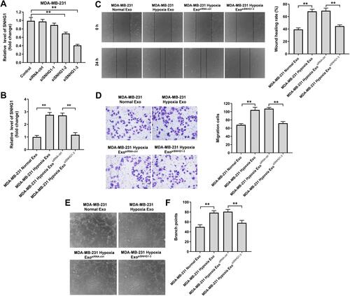 Figure 4 Exosomes derived from hypoxic breast cancer cells promotes the migration and angiogenesis of HUVECs. (A) RT-qPCR analysis of SNHG1 level in MDA-MB-231 cells transfected with siRNA-ctrl, SNHG1 siRNA1, siRNA2, siRNA3. (B) RT-qPCR analysis of SNHG1 level in HUVECs co-cultured with exosomes isolated from hypoxic MDA-MB-231 cells. (C) Wound healing assay was used to detect cell migration. (D) Transwell migration assay was used to detect cell migration. (E and F) Tube formation assay was applied to measure angiogenesis. **P<0.01.