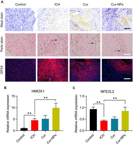 Figure 7 (A) Representative microphotographs of murine brain sections subjected to the indicated treatments and staining regimens. Scale bar: 250 μm. (B–C) The relative mRNA expression of HMOX1 and NFE2L2 in the perihematoma tissue of ICH mice in different groups. **Indicates P < 0.01.