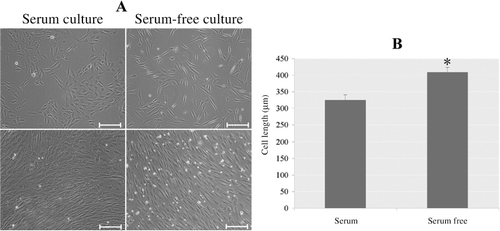 Figure 3. Morphology of subculture of rbMSCs expanded in serum-free and FBS-containing conditions. (A) Phase-contrast image of rbMSCs expanded in FBS and serum-free condition. (B) MSCs cultured in serum-free system presented a longer morphology compared to their counterparts cultured in FBS-containing medium. *P < 0.05. Scale bars: 200 µm.