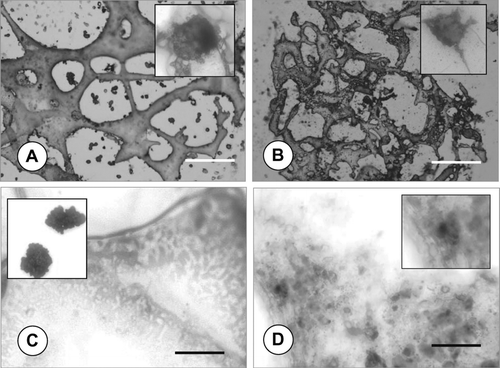 Figure 6 Light microscopy images demonstrating immunohistochemical stainings. Anti-rat Collagen type II (A, B) and Anti-rat Aggrecan (C, D) stainings of rat articular chondrocytes on PLGA sponge under static (A and C) and bioreactor (B and D) culture conditions with TGF-β 1 at Day 28; scale bars: 200 μ m.