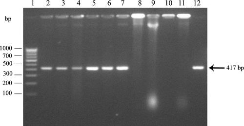 Figure 1.  Detection of Burkholderia sp. by polymerase chain reaction. Lane 1, DNA ladder; Lanes 2–7, Burkholderia sp. strain TNAU-1 colonies from the experimental field; Lane 8, Xanthomonas oryzae pv. oryzae; Lane 9, Pseudomonas fluorescens; Lane 10, Bacillus subtilis; Lane 11, Azospirillum brasiliense; Lane 12, Purified DNA from Burkholderia sp. strain TNAU-1.
