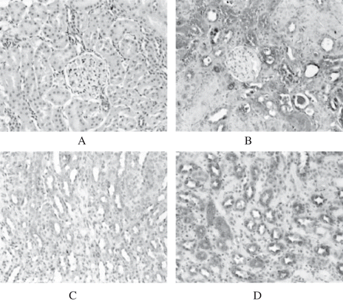 Figure 1A–D. ALR expression in rat kidneys. No ALR expression could be detected in the renal cortex of normal rats (A). However, ALR expression in the cortex of GM+saline rats was increased markedly (day 8) (B). In the renal medulla, faint expression of ALR was detected in normal rats (C). Expression in the medulla was increased significantly in GM+saline rats (SABC, ×200) (D).