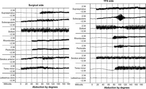 Figure 4 Electromyography of patient who had right shoulder rotator cuff repair, and used yoga for subsequent complete left cuff tear.