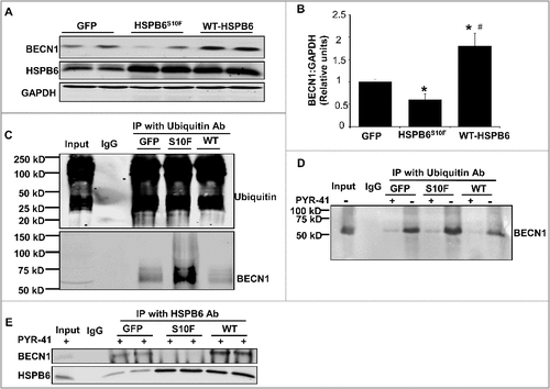 Figure 6. Acute overexpression of HSPB6 WT and HSPB6S10F in adult rat cardiomyocytes and examination of the expression and ubiquitination levels of BECN1. (A to C), HSPB6 WT increased BECN1 protein levels and reduced its ubiquitination, whereas, expression of BECN1 was decreased and its ubiquitination was increased in HSPB6S10F cardiomyocytes: 4 independent experiments were performed using 4 adult rat hearts. Values represent means ± SEM; *: P < 0.05, vs GFP; #: P < 0.05, vs HSPB6S10F; (D and E), The ability of BECN1 to interact with HSPB6 is independent of its ubiquitination. (D), PYR-41 (ubiquitin-activating enzyme E1 inhibitor) abolished BECN1's ubiquitination (+: PYR-41 treatment, -: PBS control); (E), Decreased interaction of HSPB6 with BECN1 in HSPB6S10F cardiomyocytes in the presence of PYR-41: 4 independent experiments were performed using 4 adult rat hearts.