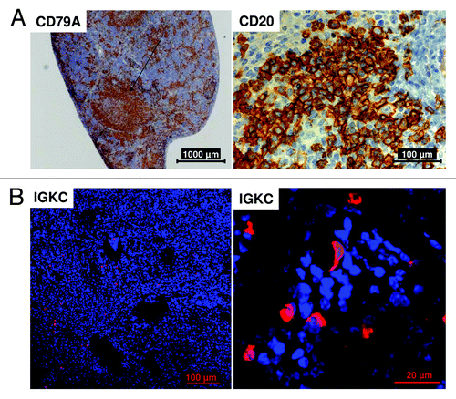 Figure 4. Human B cell maturation in the spleen of HTM. Histological sections of the spleen of BT474 transplanted HTM (A) show B cell cluster formation (CD79A+) and a positive staining of the CD20 antigen. (B) The staining of Immunoglobulin kappa constant (IGKC) protein indicates the presence of antibody producing plasma cells. Bars indicating the corresponding sizes (20, 100, 1000 µm) are shown for each specimen.