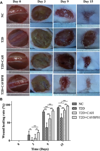 Figure 4 The effects of hydrogels on skin wound healing in type 2 diabetes mellitus (T2D) by topical treatment. (A) Representative images of wounds in the normal control (NC) group, T2D group, CAH (T2D+CAH) group, and CAVBPH (T2D+CAVBPH) group on days 0, 3, 9, and 15. (B) Wound healing rate. *p < 0.05, **p < 0.01, and ***p < 0.001.